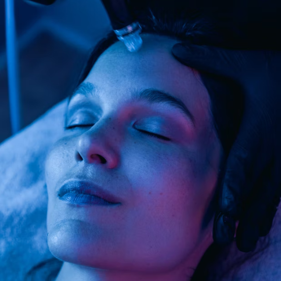 microneedling southend on sea